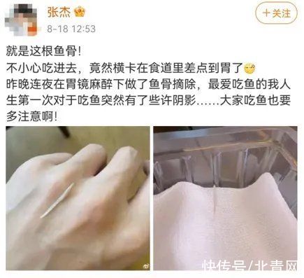 武汉大学|遭遇鱼刺卡喉，他的这个做法值得学习