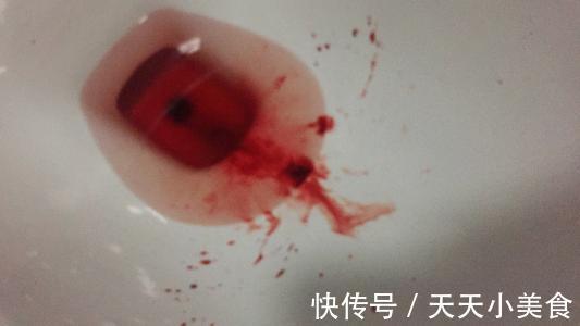 腹痛|本以为是肠胃炎，却查出宫颈癌，医生：身体这3异常要及时检查HPV