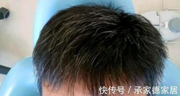 白发|民间一个土秘方,不管白发多严重,让你从此告别染发,了解一下