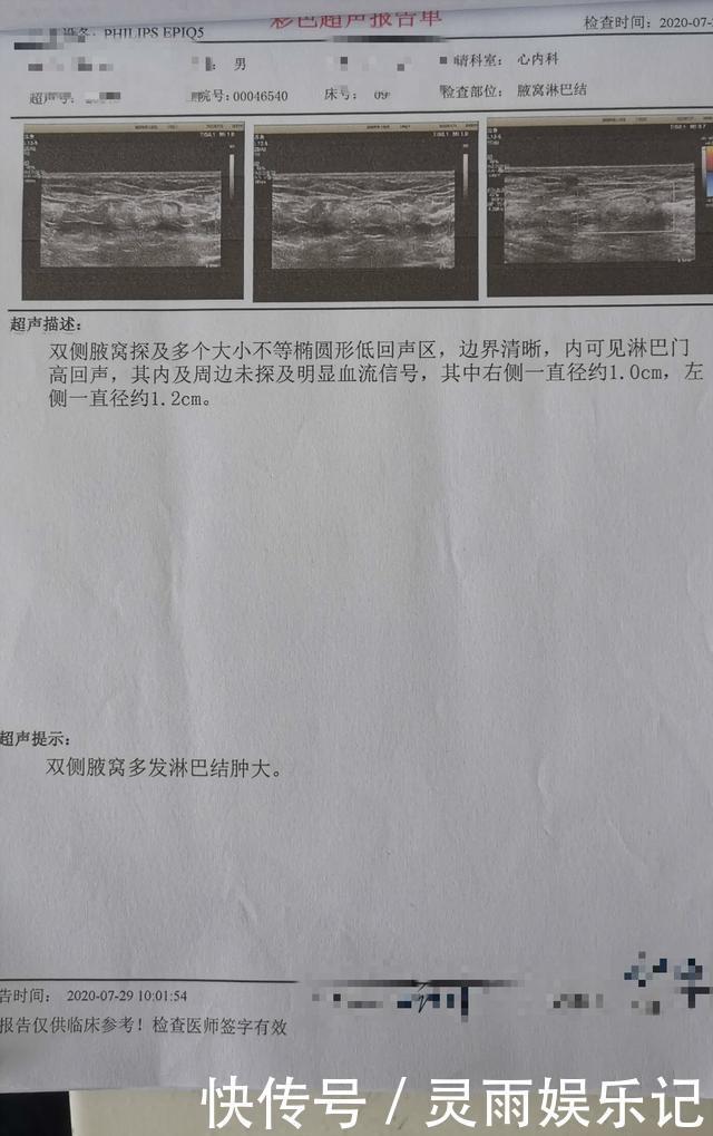 肝癌早期,身体这6处会亮“红灯”!希望你早点抓住