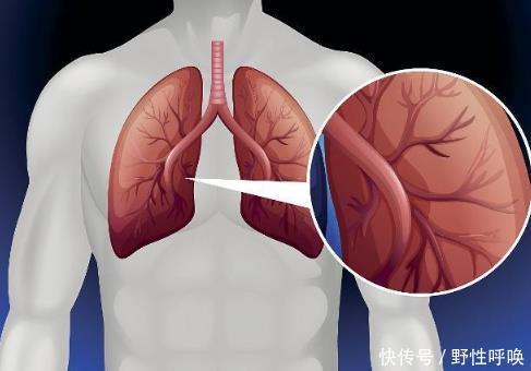  当回事|以下5个表现，是肺部问题发出的信号，收到的人不要不当回事