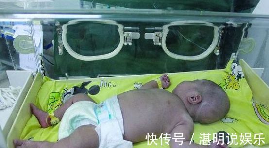 小编|3个月孩子手掌面临截肢，医生取出的东西，宝妈气的手抖