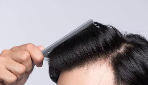 头发出油或与这几个原因有关!做好这3点,可改善出油现象