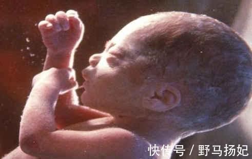 发育不良|胎儿畸形最喜欢出现在这个月份,孕妈只要熬过去就轻松了