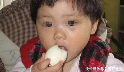 检查|一天一个鸡蛋,3岁宝宝吃出事了检查后发现,惹祸的不止是鸡蛋