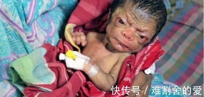 一家人|印度13岁少女嫁给亲哥哥,当他们孩子出生后,一家人大闹医院