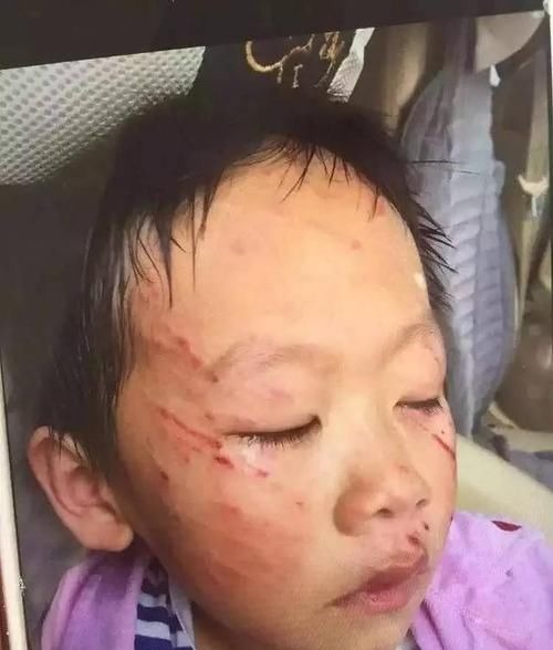 孩子|“爸爸,我真的起不来了,拉我一下吧”,这是6岁女孩最后留下的话