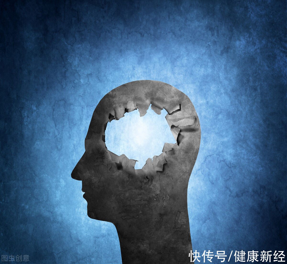 不良习惯|老年痴呆并不可怕，提前预防是关键，生活中应该怎么做？