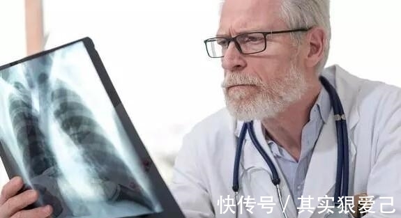 胸腔积液|癌症晚期出现胸腔积液,还有没有办法去应对?