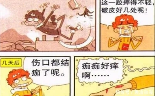 伤口|爆笑阿衰：小衰伤口变刮刮乐最后刮出一个大奖？花式解释“便签”