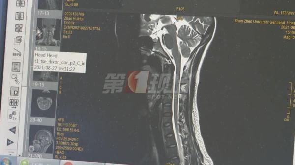 张红鸭|全身换血！男子手脚“软趴趴”9年，在深圳找回了“力量”…