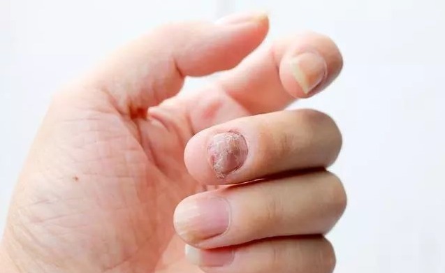 红枣|112个名老中医贡献的祖传秘方,个个见功力!取材易花钱少疗效好