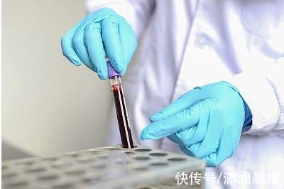 hiv病毒|成功治愈！世界上第三例艾滋病痊愈患者，使用了这种新疗法