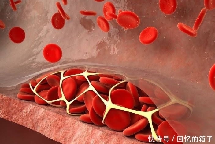 保护血管|血管“清道夫”被找到了，每天吃一点，可养护血管，预防血栓