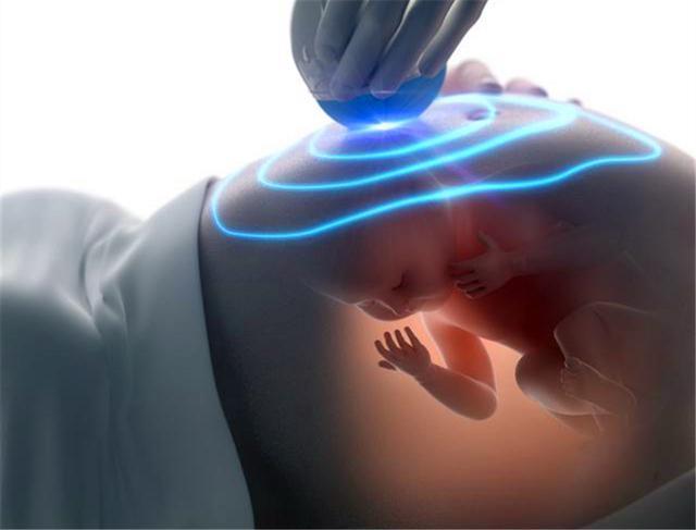 肚子|孕妇有这4种反应，多半是怀了个''小淘气''，将来要多费心了