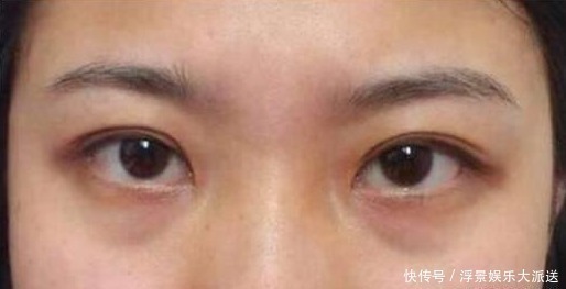 湿热|湿气重的人，脸上会发出3个信号，去除湿气，做三事、按四穴