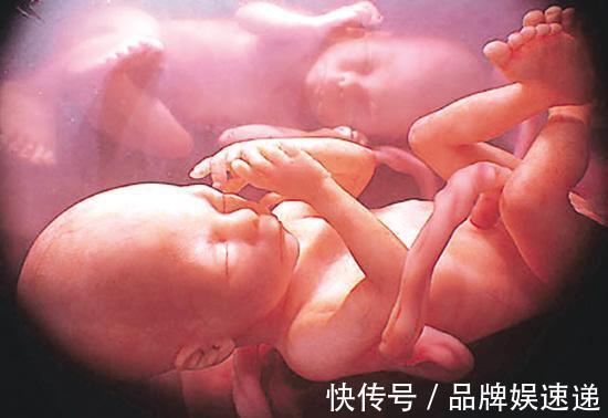 产检|孕妈要警惕睡觉姿势，小心引发胎儿的脐带绕颈，脐带绕颈有预兆