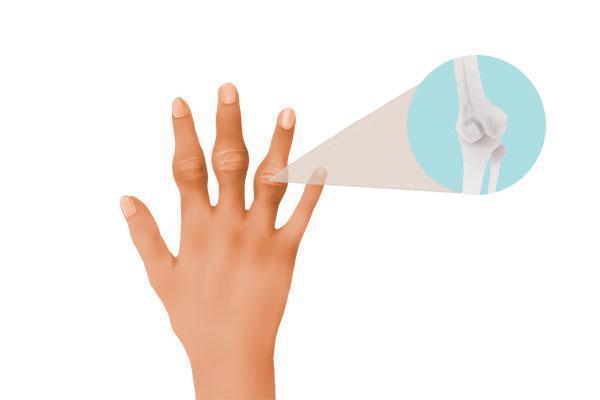 脾气虚|人若脾虚,身废一半!脾虚的人,会收到接二连三的警报,一看就知