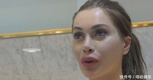 整形手术|美国一女子去韩国做危险极高的额骨手术,还说整容上瘾