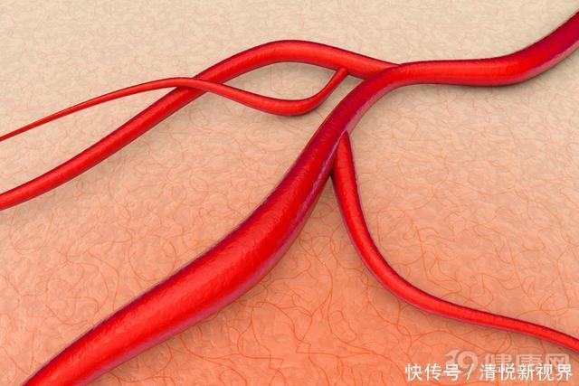 食用|每天早上吃鸡蛋,会增加心血管死亡率北大40万人研究给出答案