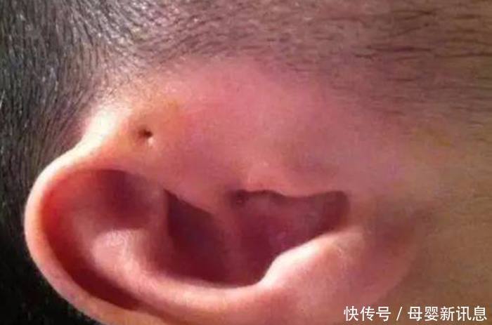 老人常说宝宝"耳垂"有福相,但是这样的耳朵,大家要走注意了_【快资讯