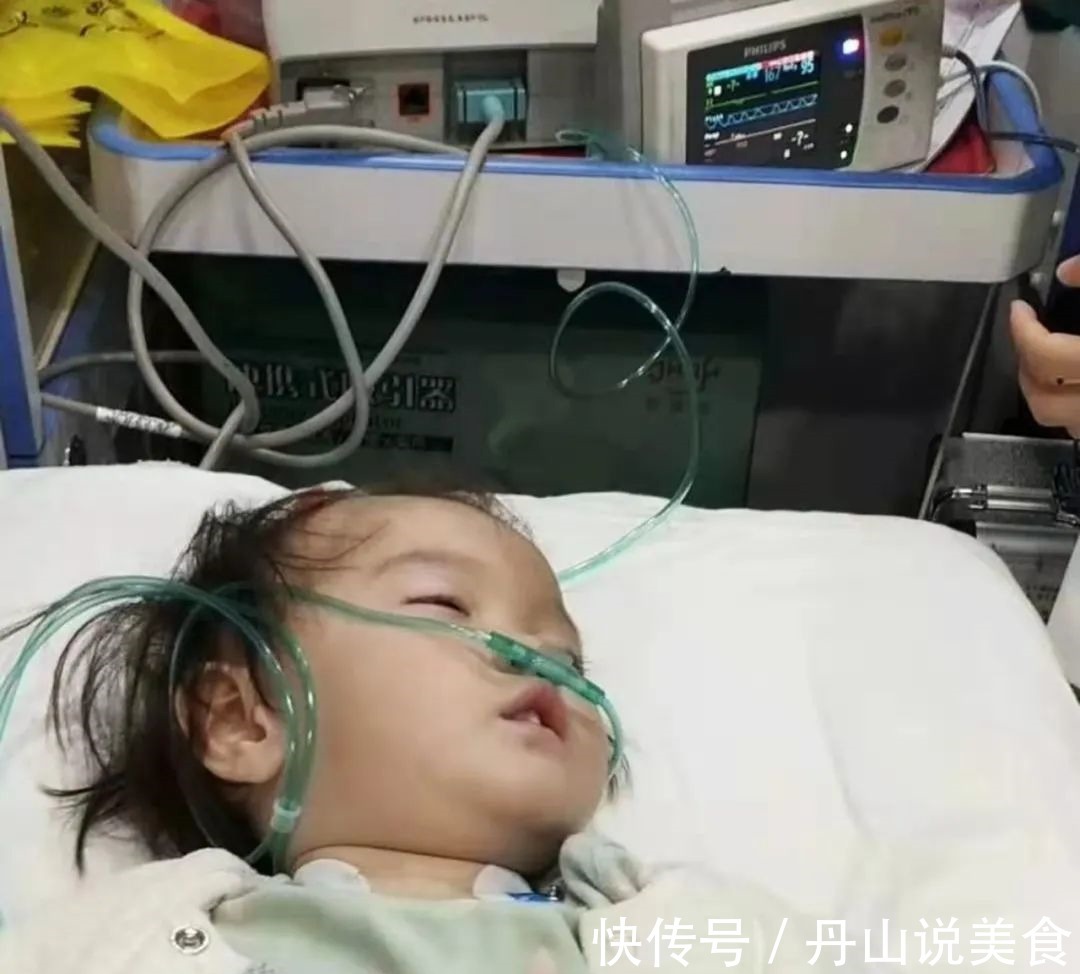 治疗费|漂亮女童身怀“特异功能”,没有痛觉,不会出汗,爸妈却因她流泪