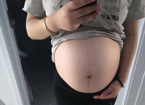 孕妇|孕妇nt查出畸形，准妈妈第一次听说，奇了个怪