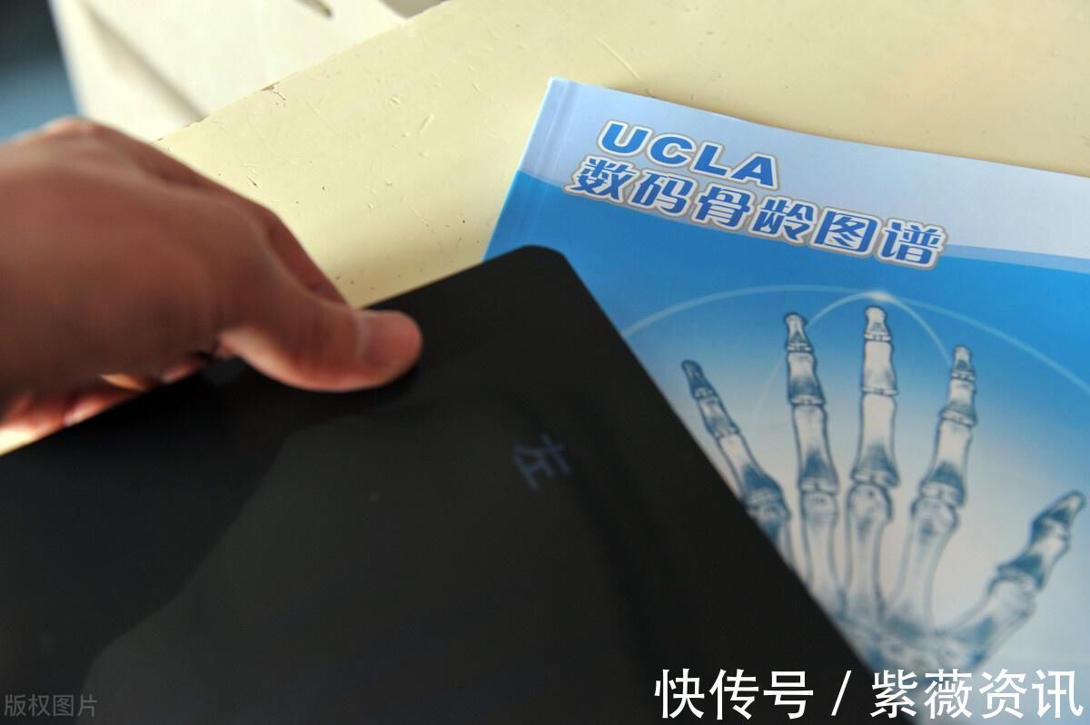 骨龄|想知道自家孩子未来身高,能不能科学预测?