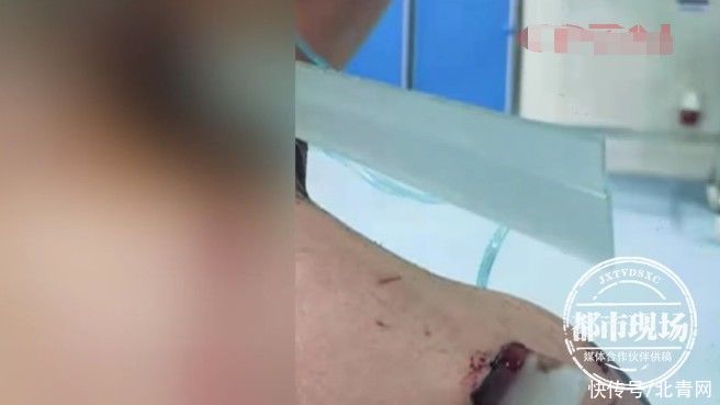 玻璃|20岁小伙上厕所玩手机 最后晕倒在地