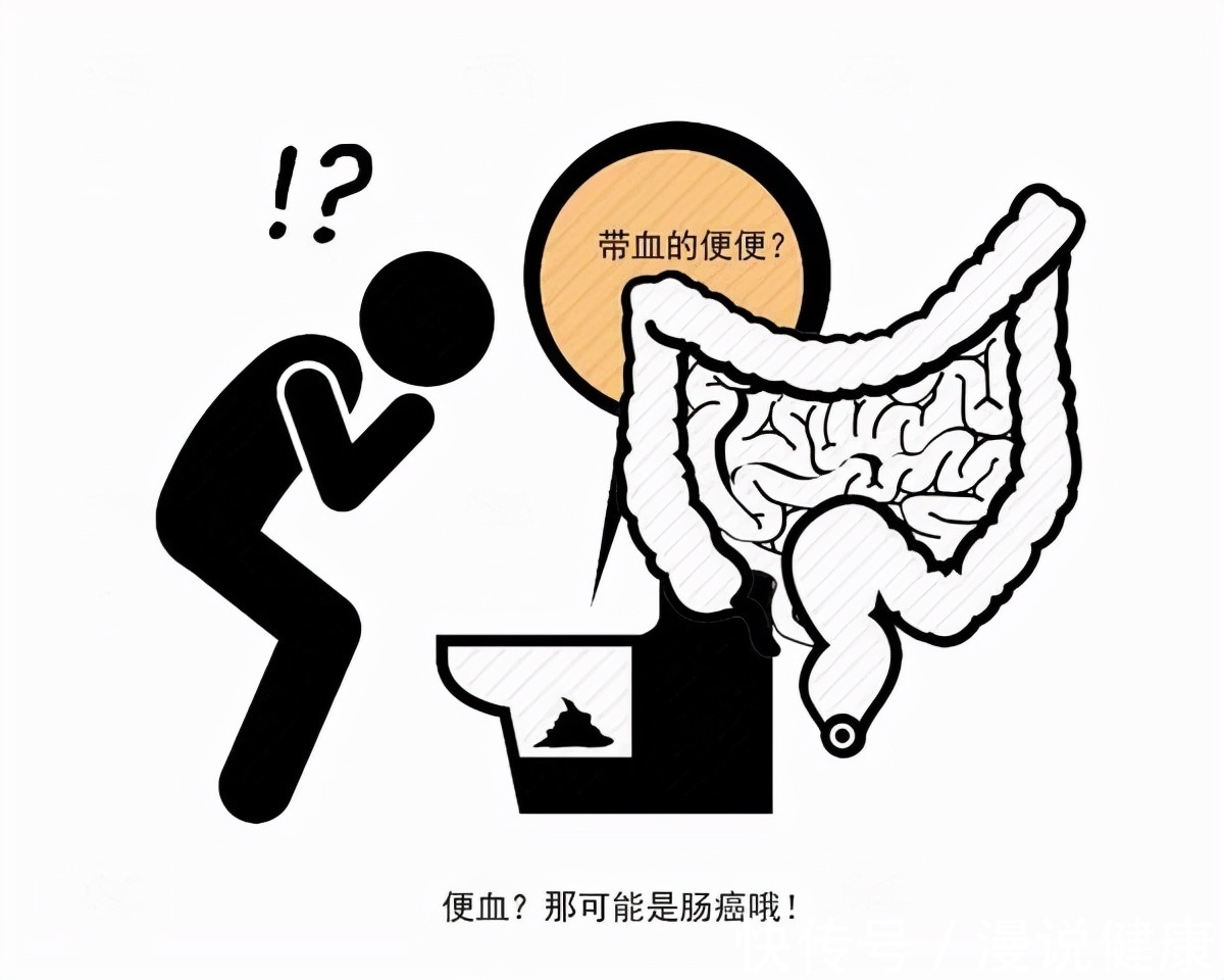 肠癌|抗癌博主阿健病逝:死亡率排名第二!这种癌症开始“盯上”年轻人