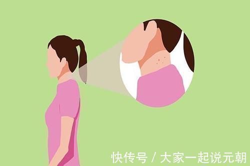规则性|皮肤下面长出大包,是癌症信号?医生哭笑不得:满足3点才有可能