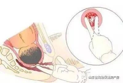 手指|生娃“开十指”真是十个手指吗？看完才明白