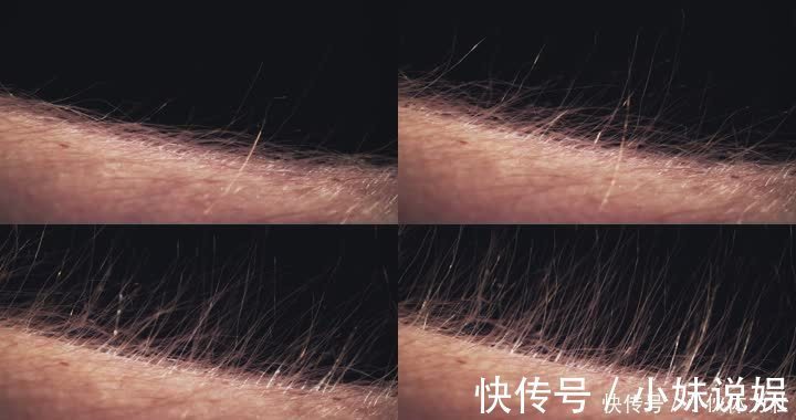 体毛|为什么有的女性体毛旺盛，有的女性几乎没有？和什么有关？