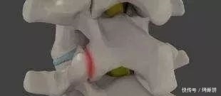 听朋友说是肾不好所以才会腰疼，这是真的吗？