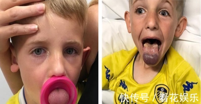 舌头|女孩喝水被水杯“卡住舌头”,家有这类水杯要注意,别给孩子用了