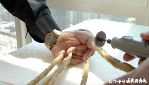左手|老人用44年时间蓄留指甲,一朝剪掉后,不料手指却发生了新变化