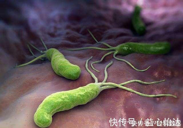 虫子|幽门螺杆菌最怕不是“大蒜”，而是这1物，经常吃，胃会感谢你