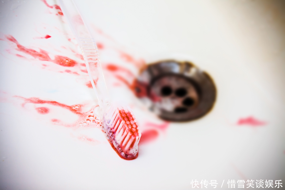 常吃|两种常见的蔬菜,是天然的“阿司匹林”,常吃远离心梗和脑梗