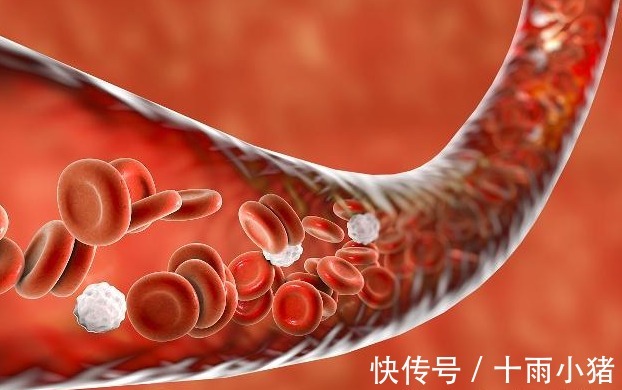 血管|血液粘稠的人,可能有4个症状,若你一个没有,恭喜血管挺干净