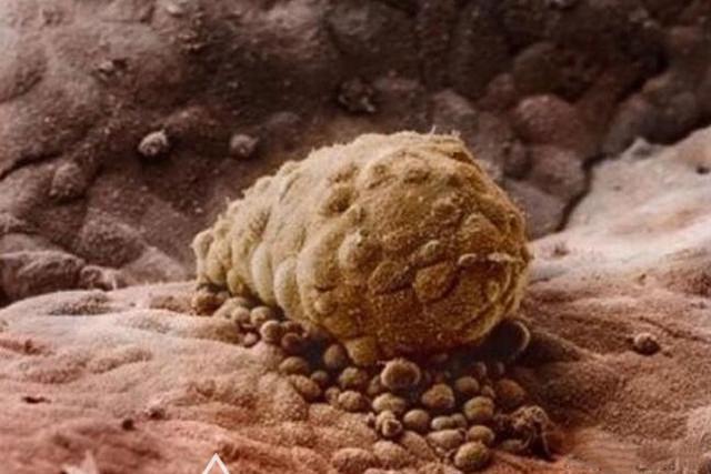 奇迹|10月胎儿形成全过程,8张图带你了解真相,感受生命的奇迹