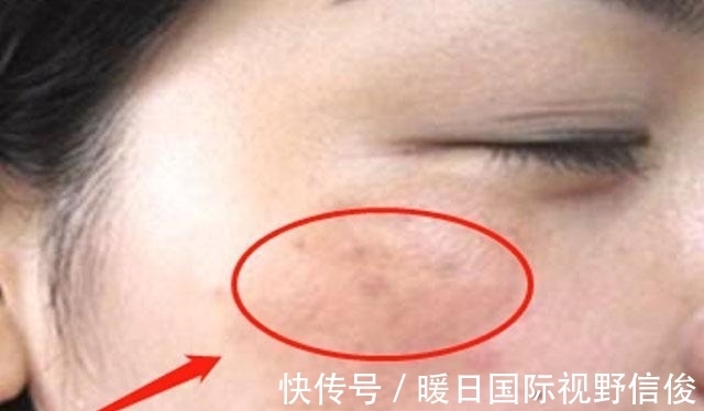 百合|子宫健康的女性,脸上不会有4种表现,常喝1种水,子宫更光滑