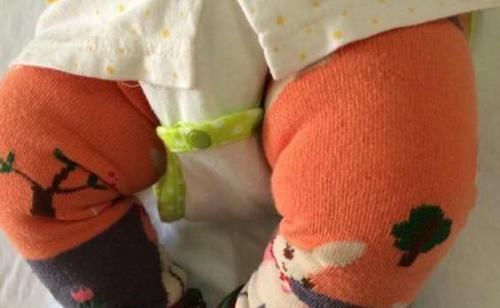 宝宝|3岁女儿说“屁屁疼”,宝妈带孩子看医生,原因竟是婆婆惹的祸