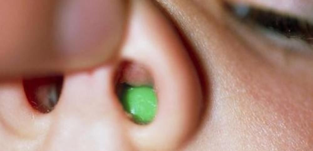 宝妈|3岁女孩散发恶臭,宝妈慌忙就医,医生发现问题出在鼻子里