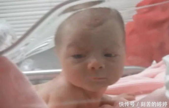 医生|刚出生两天的婴儿听到妈妈的声音，居然抬头看妈妈，医生都看愣了