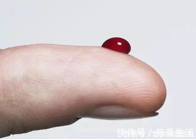 血糖|血糖高的人，身体会出现3个异常，若一个没有，血糖控制得还不错