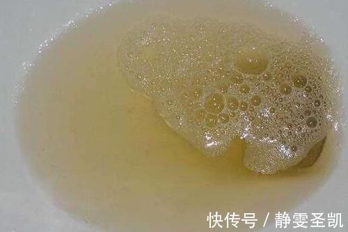 糖尿病肾病|患上糖尿病，尿液会发生什么变化？这3个变化还需警惕！