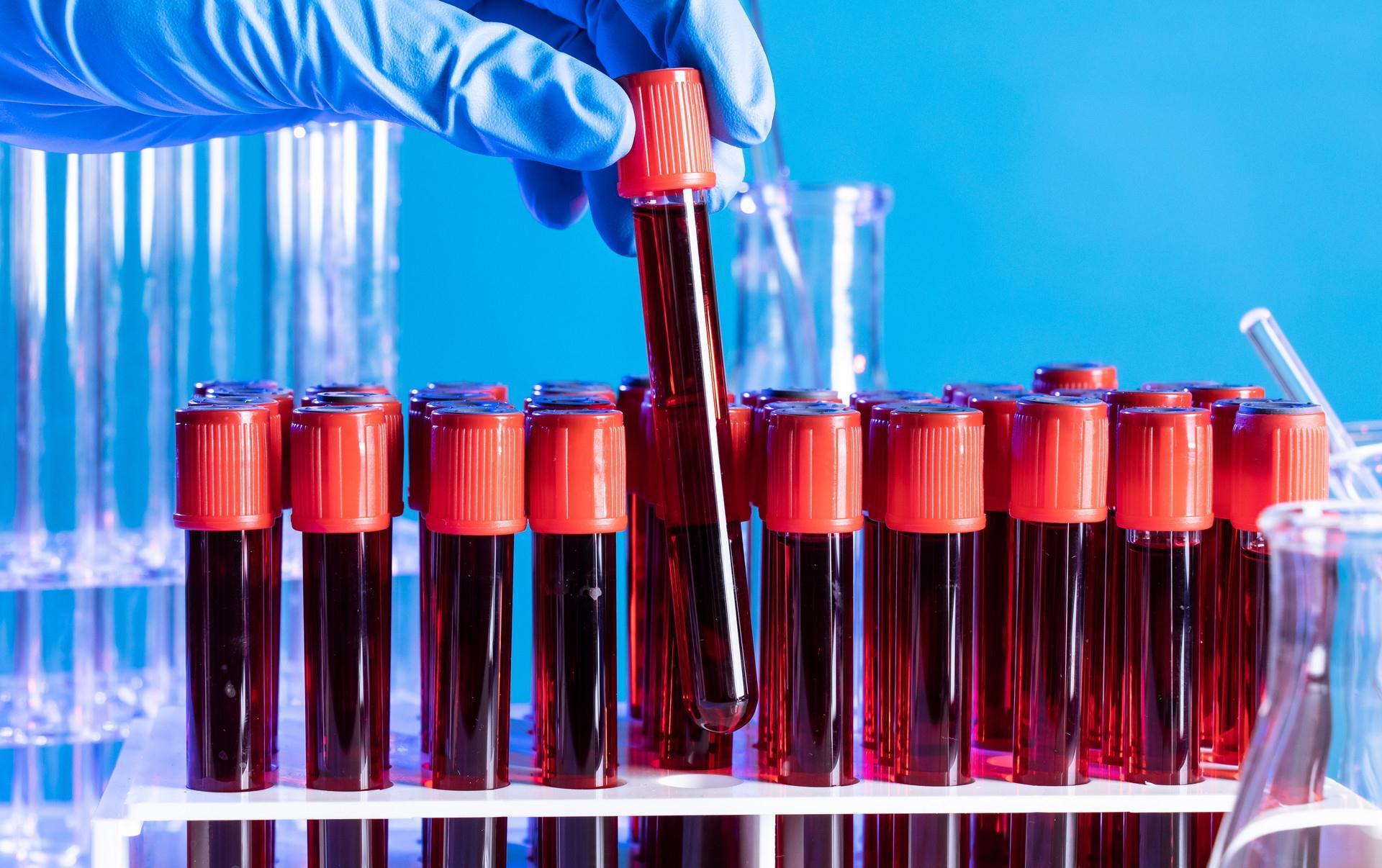 手术|胃癌手术不是一劳永逸,仍有复发风险,术后随访要重视