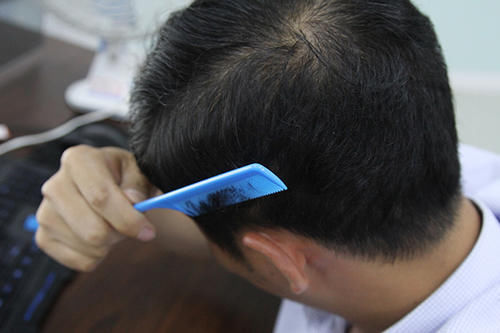 食物|脑供血不足，吃什么比较好？专家提议适当补充4种食物，对血管好