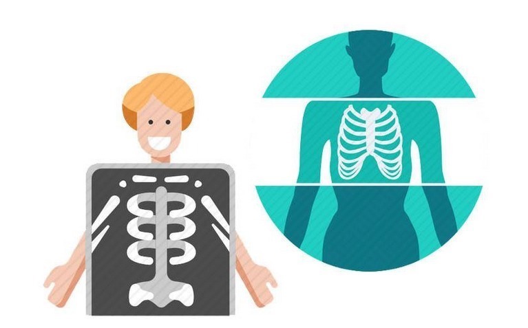 照射者|甲状腺癌发出的首个信号，往往很多人都忽视？这4类人可得留点心