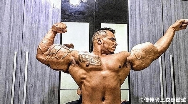 小伙子|还记得巴西那位向手臂注射燃油的小伙子吗 这是他3年后的样子